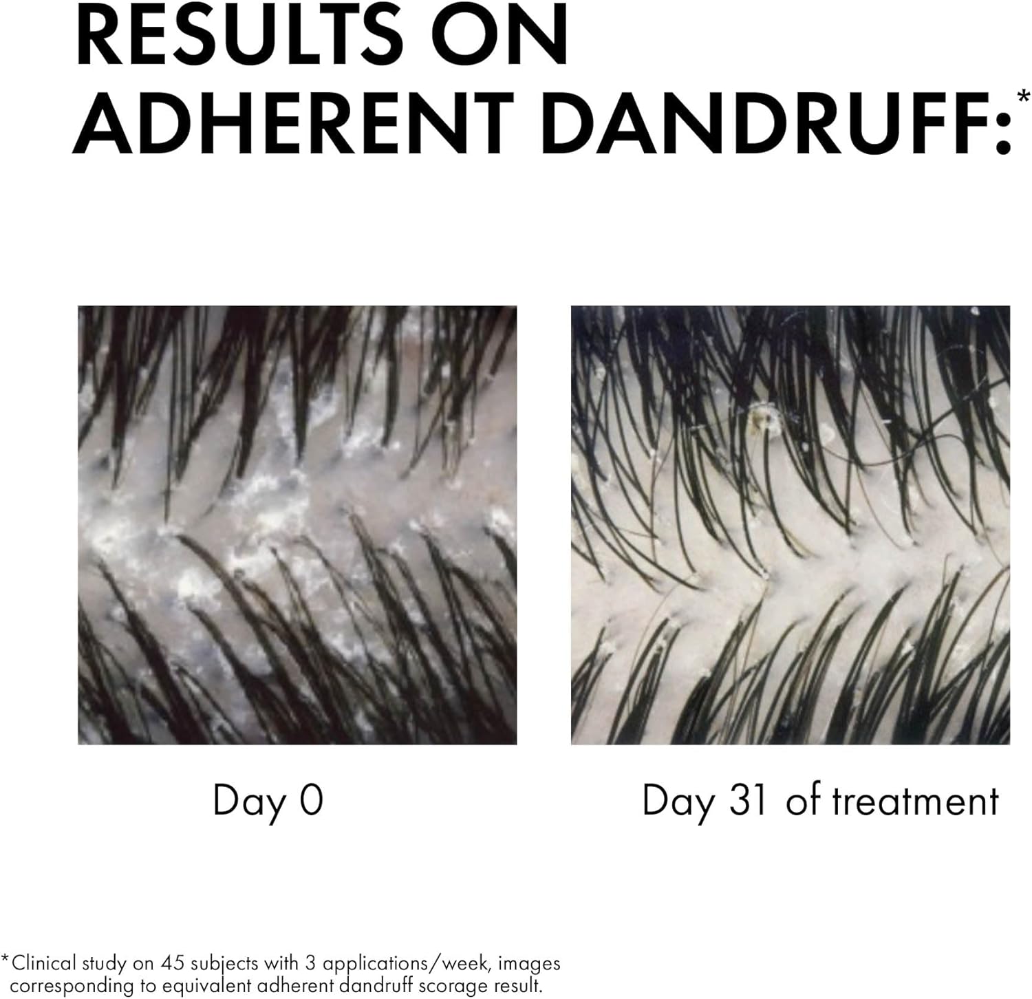 Vichy Dercos Anti Dandruff Shampoo for Normal to Oily hair - Image 4